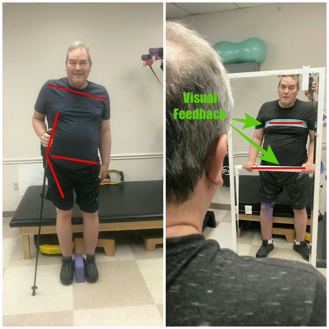 patient standing in front of a mirror
