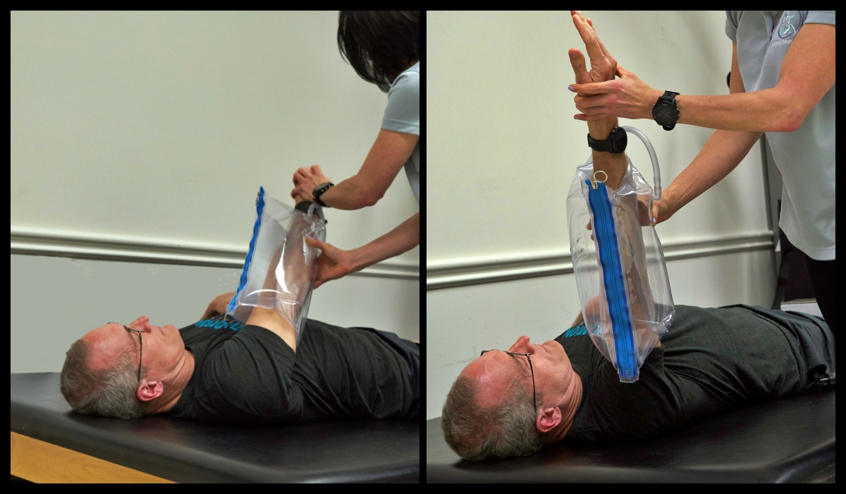 therapist helping with stroke arm exercise