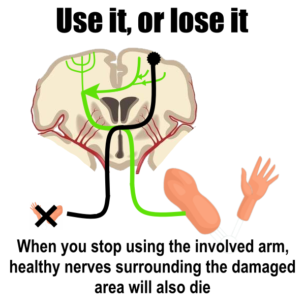 vector image of use it or lose it principle