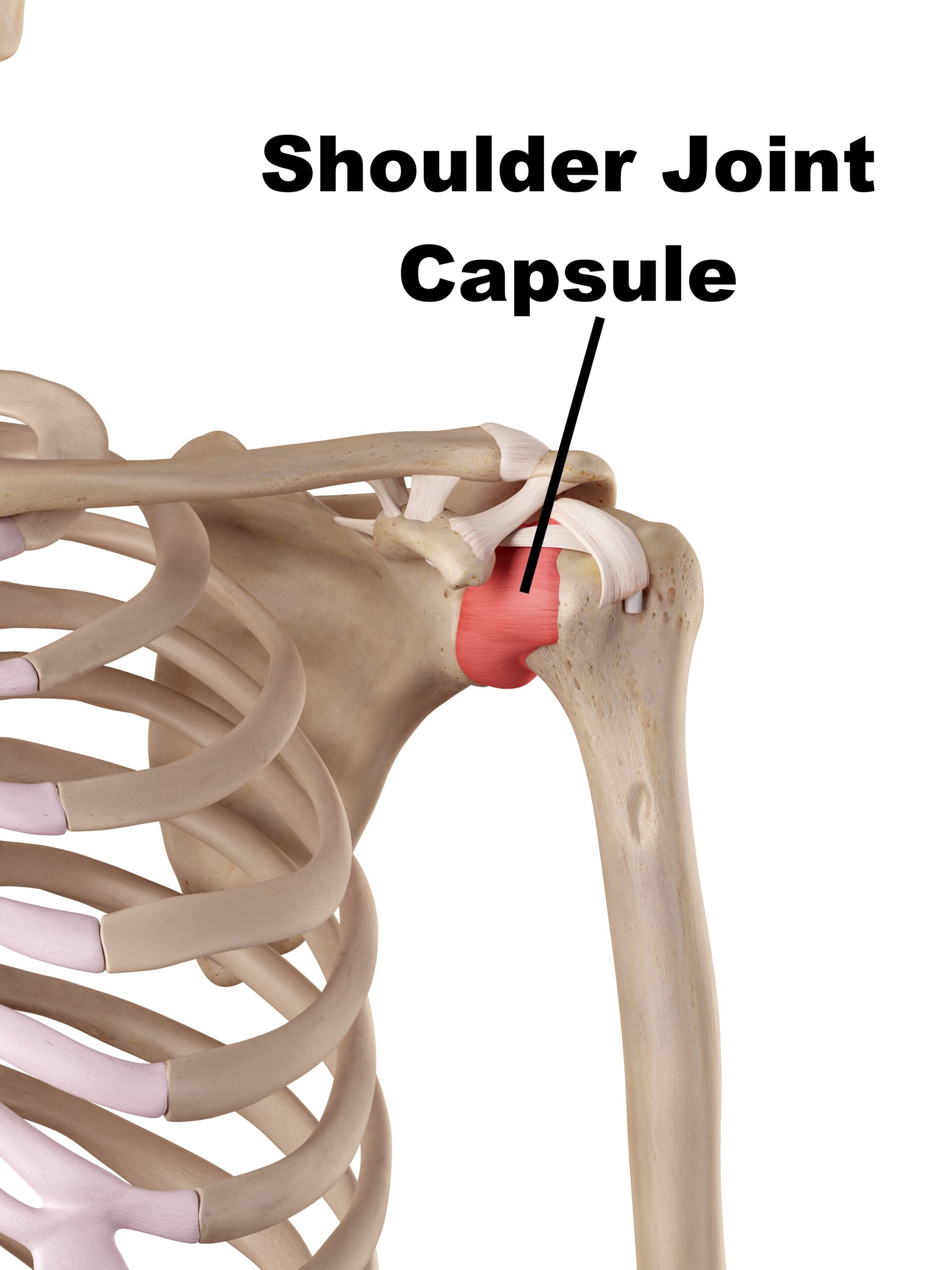 image of frozen shoulder