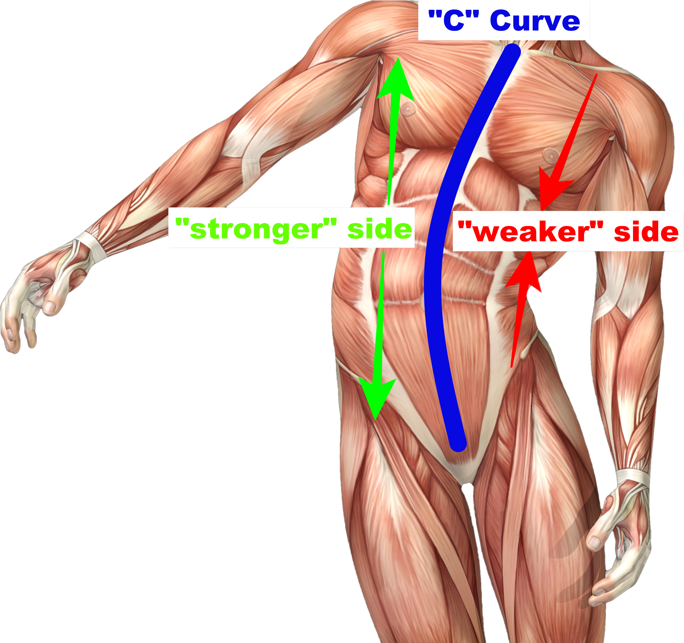 side bent posture