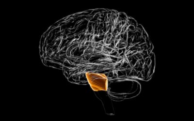 Pontine Stroke: Everything you need to know