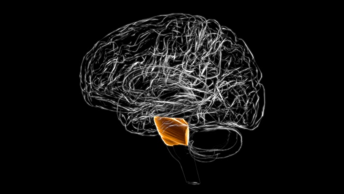 Pontine Stroke: Everything you need to know